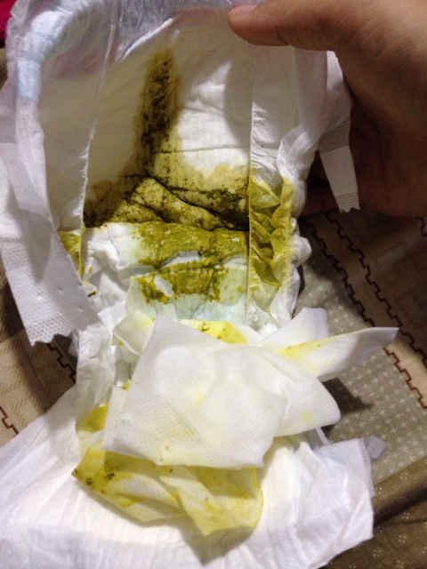 三个月大的宝宝拉这样的粑粑正常不?