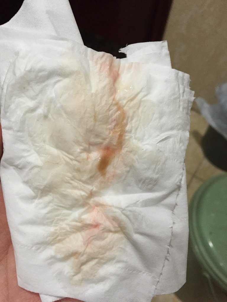 孕39周,是见红了吗?