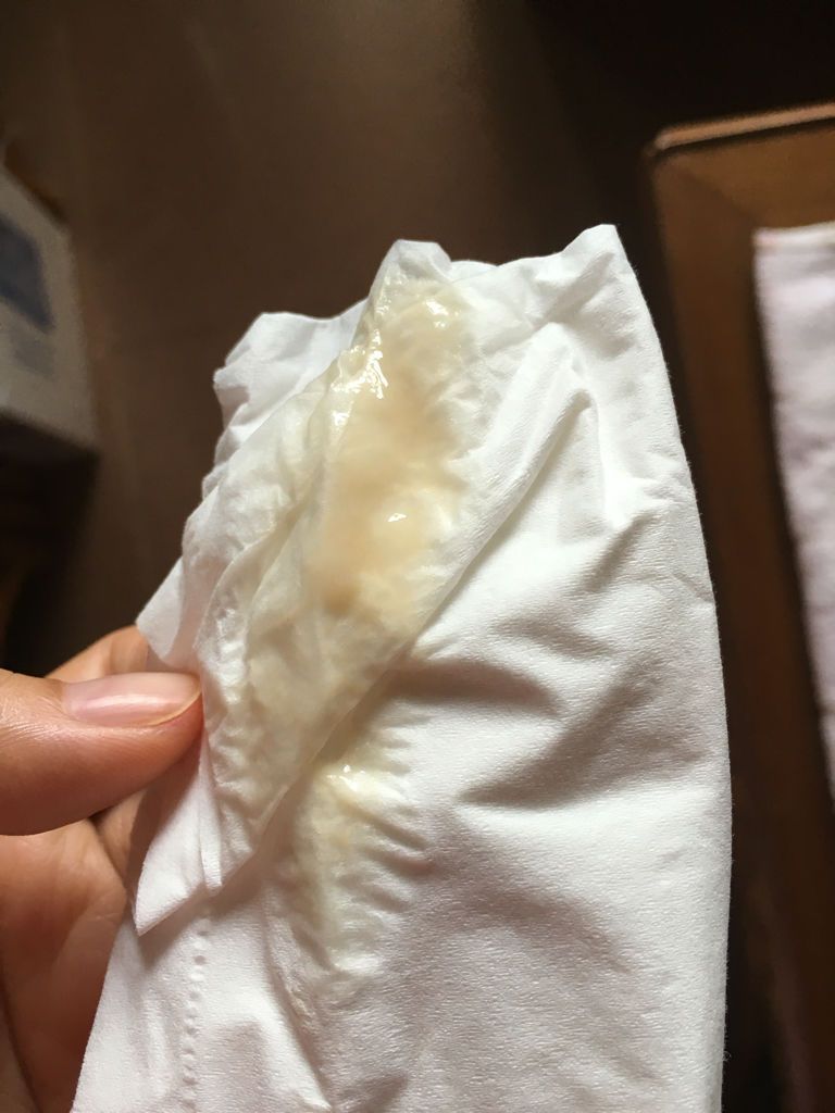 月经一直不正常,这个月又17 天没来啦!