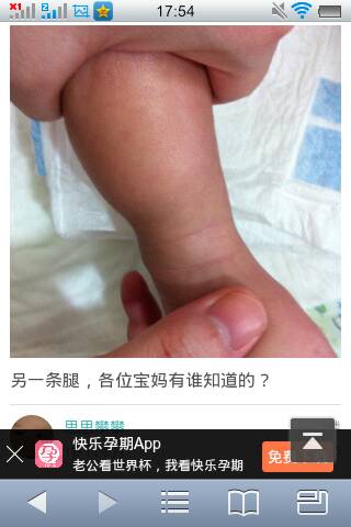 婴儿脚踝纹不对称图片图片