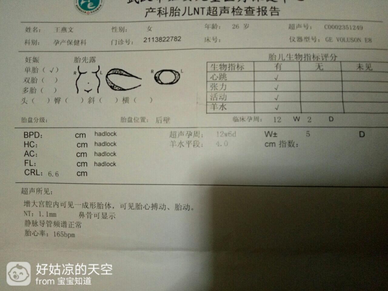 市妇幼医院做的nt.啥数据都没有 看不懂请懂的亲们指点