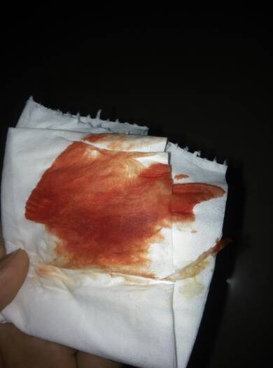 橙红色月经血图片图片