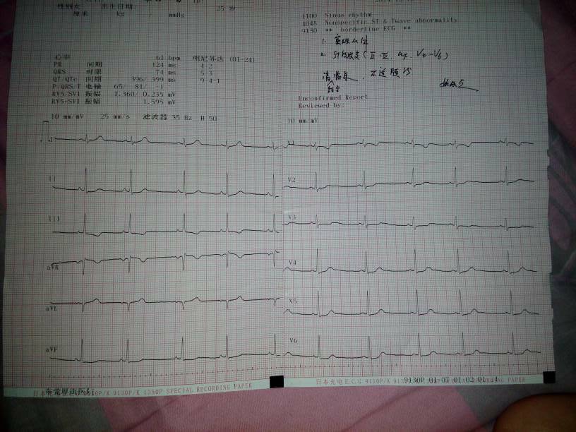 剛做了心電圖,報告說竇性心律,st段改變 附圖如下,求醫生幫忙
