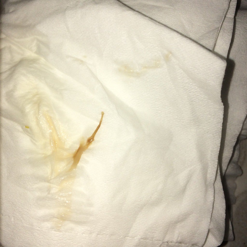 怀孕6周零6天今天早上的时候感觉有一点褐色的白带不怎么明显,到晚上