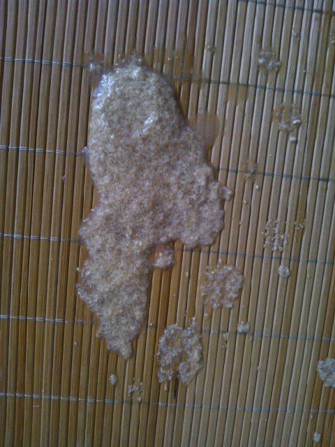 宝宝拉豆腐渣样米白色便便