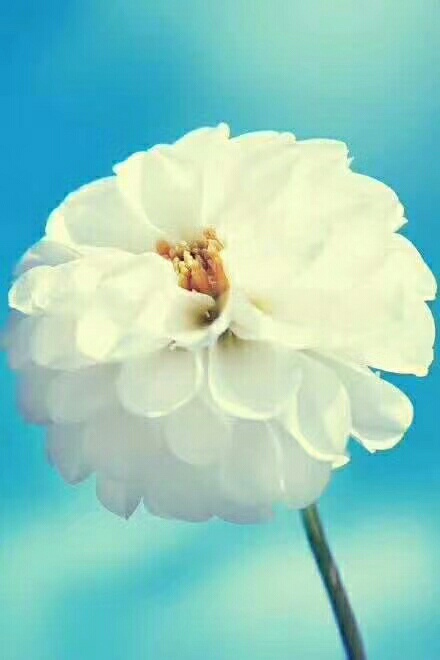 听说妊娠线能判断孩子男女,妊娠线是什么?