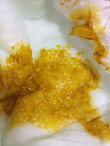 四十多天母乳喂养宝宝大便,正常吗?