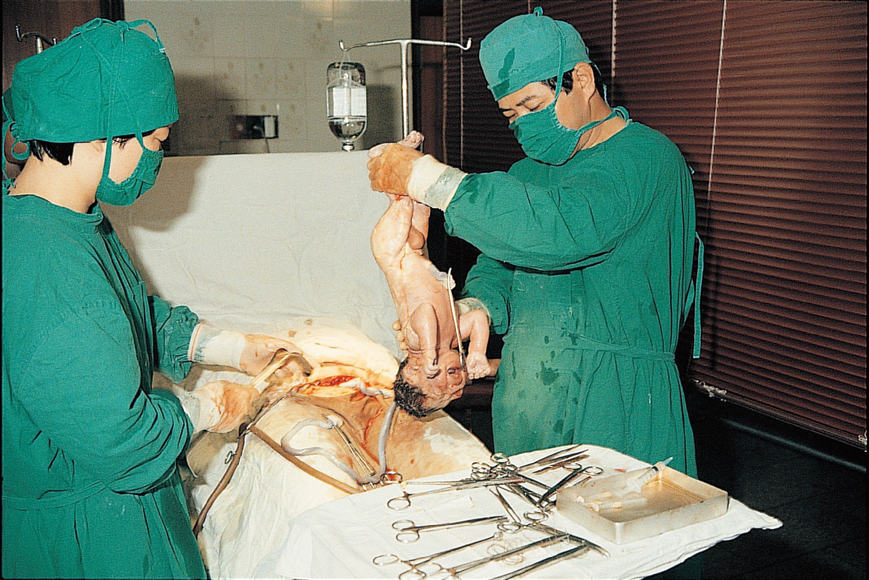人体解剖手术 真实图片