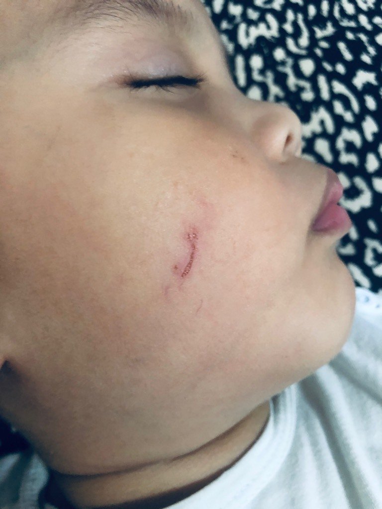 要找老师问清楚了原因了,还有就是让打人小孩的家长出来知道这件事情