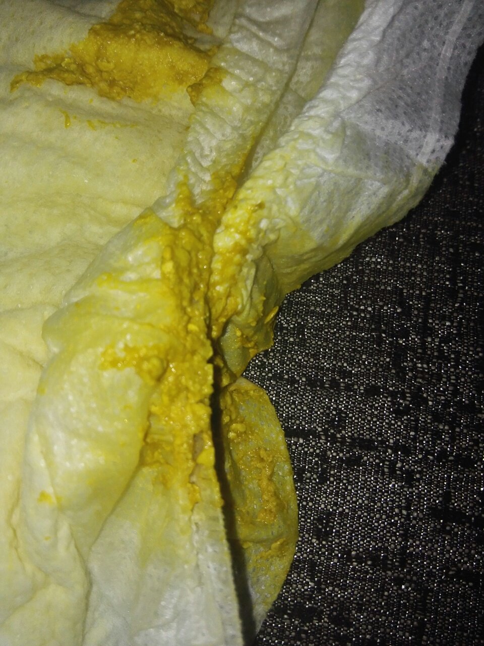 宝宝出生50天帮我看看这样是拉肚子吗前两天还是一天拉一次这两天一天