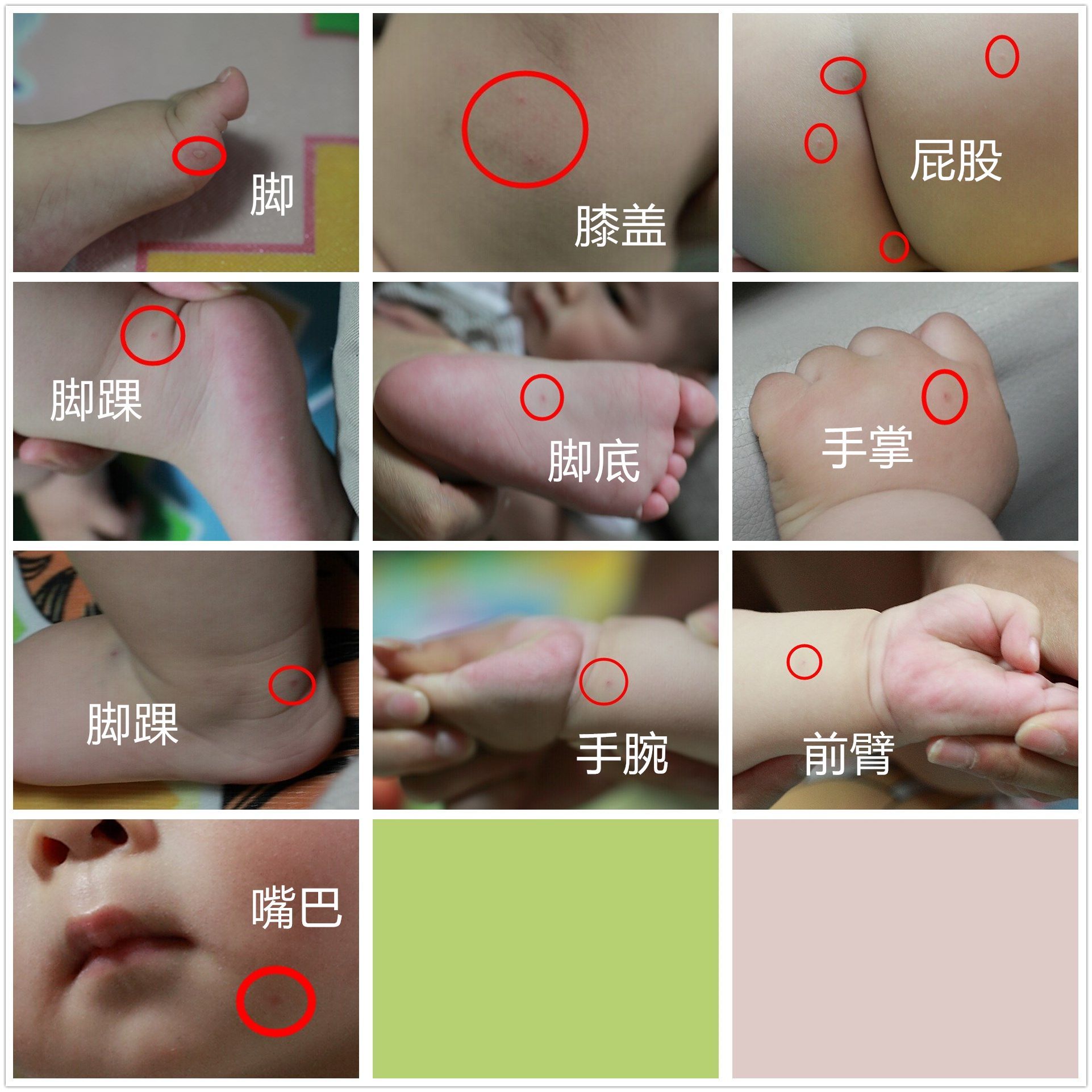 去医院打了两天吊针,每天分别是1,氯化钠 头孢替安,2,葡萄糖 利巴韦林