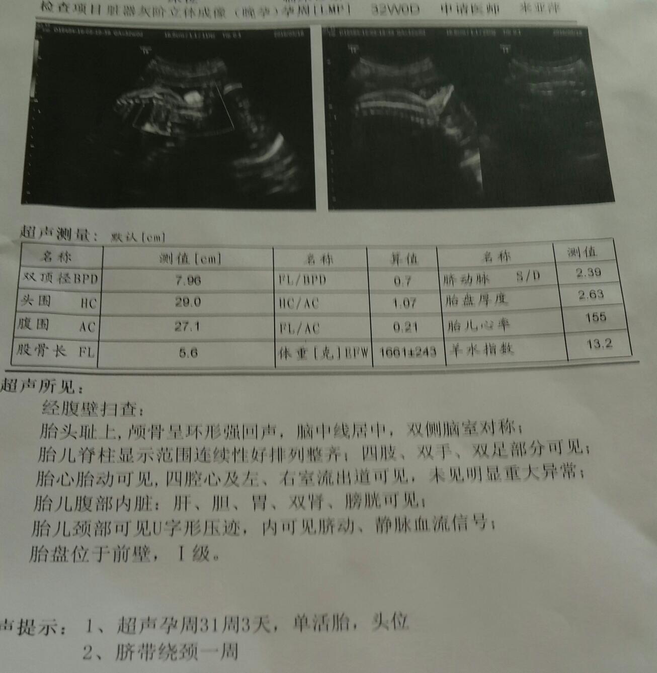 产检单子的秘密