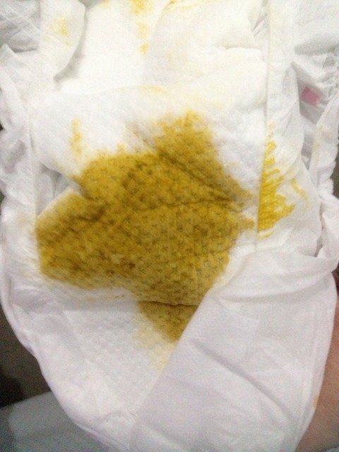 急急 拉这样子 水一样 是拉肚子吗 一天3至4次