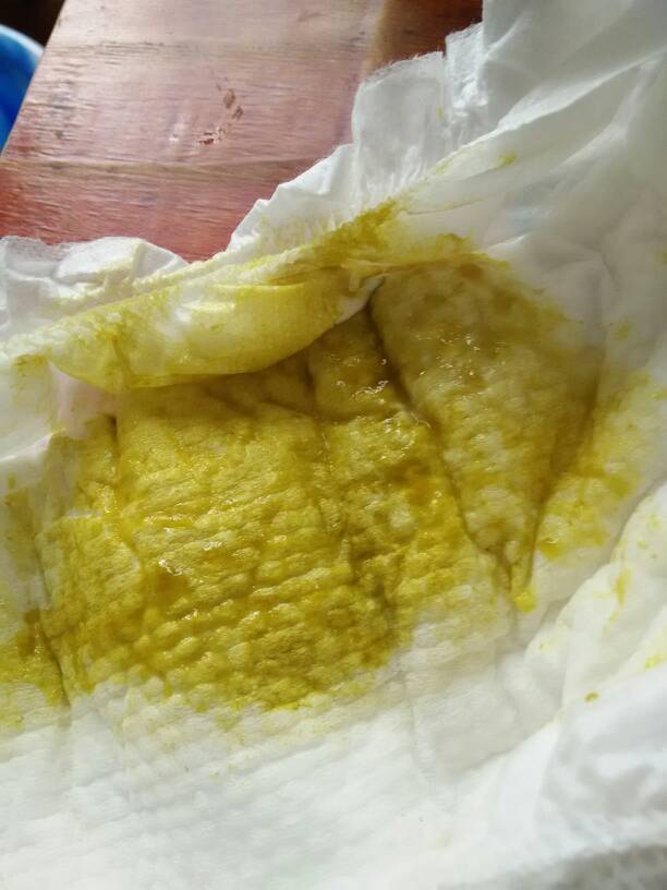 粑粑颜色上图 是不是拉肚子还是受凉引起的啊 - 百度宝宝知道