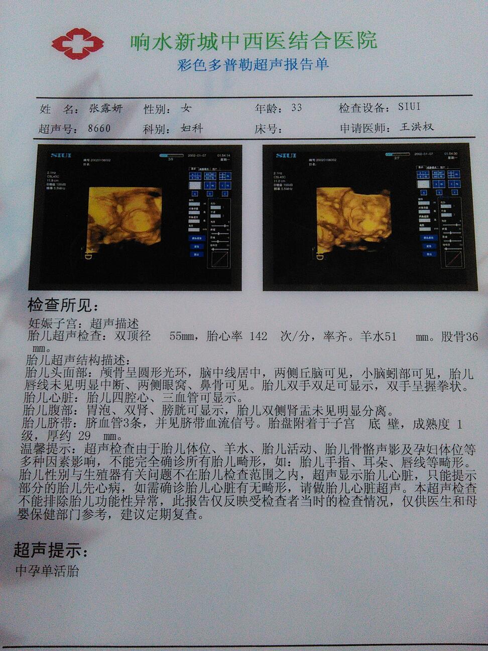 10月21号,孕22周四维的宝妈们,来聊聊吧!