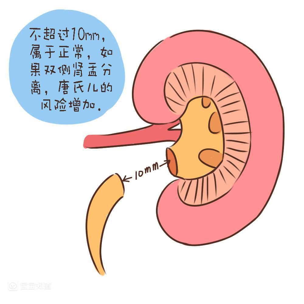孕妇怀孕五个月b超检查说胎儿双肾盂分离这是什么原因