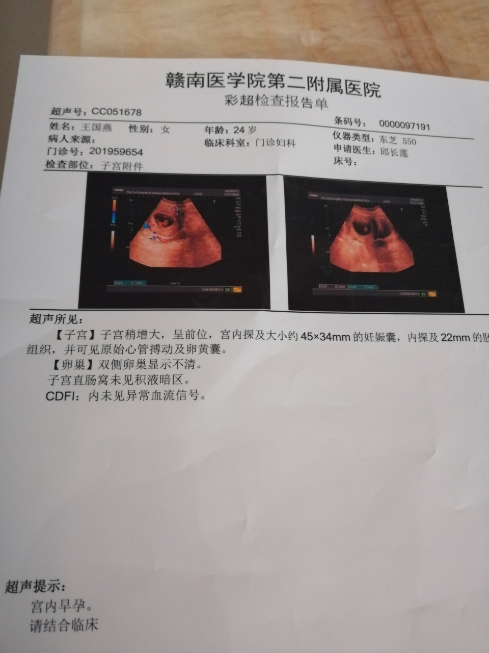 孕囊数据看男女,懂得帮看看