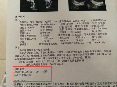 yy.vip易游-全球乳腺癌重磅数据出炉：发病率持续上升今年你做了检查吗？
