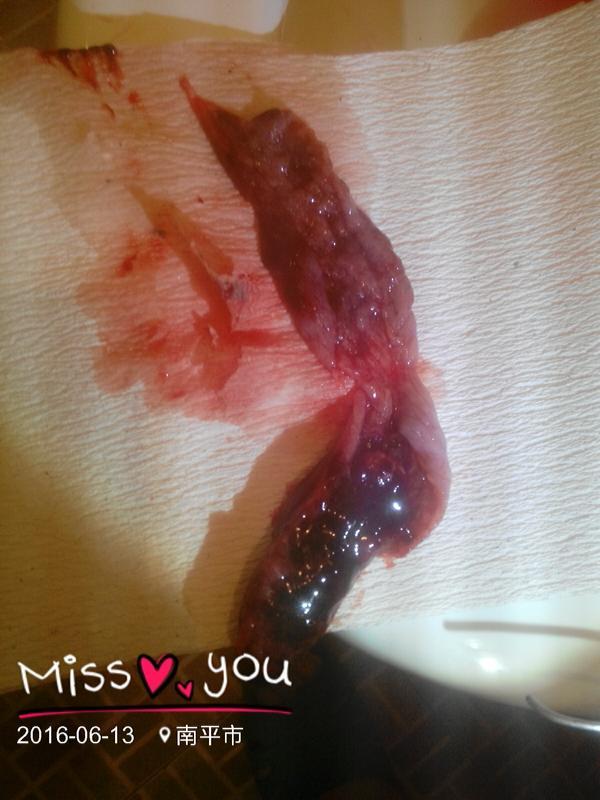 怀孕两个月,最近有出血几天,刚上洗手间,还有流血跟来大姨妈一样,肚子