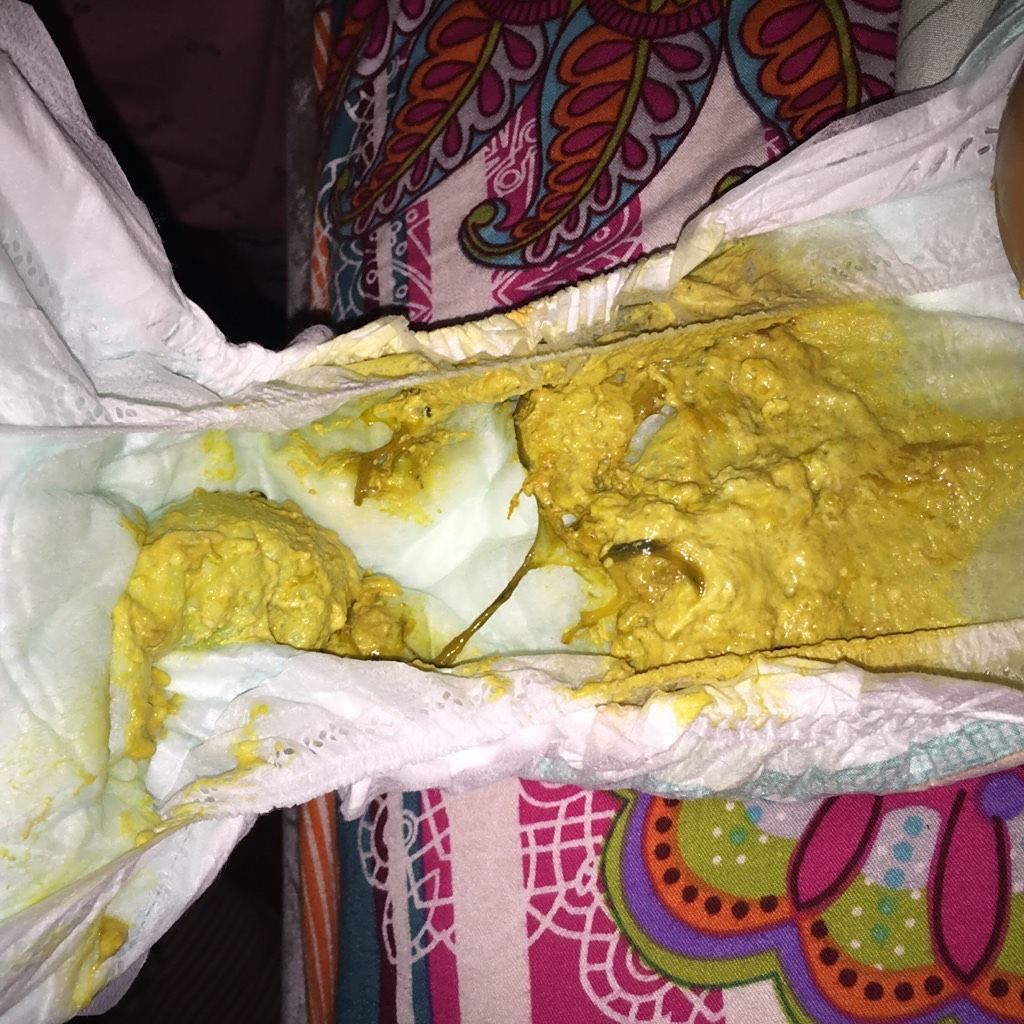 四月婴儿大便里有黑色细长的黏液,请问是什么