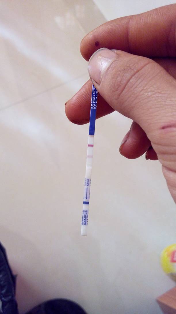 其他回答 你好,根据你的描述早孕试纸显示两条红线,首先考虑是怀孕了 