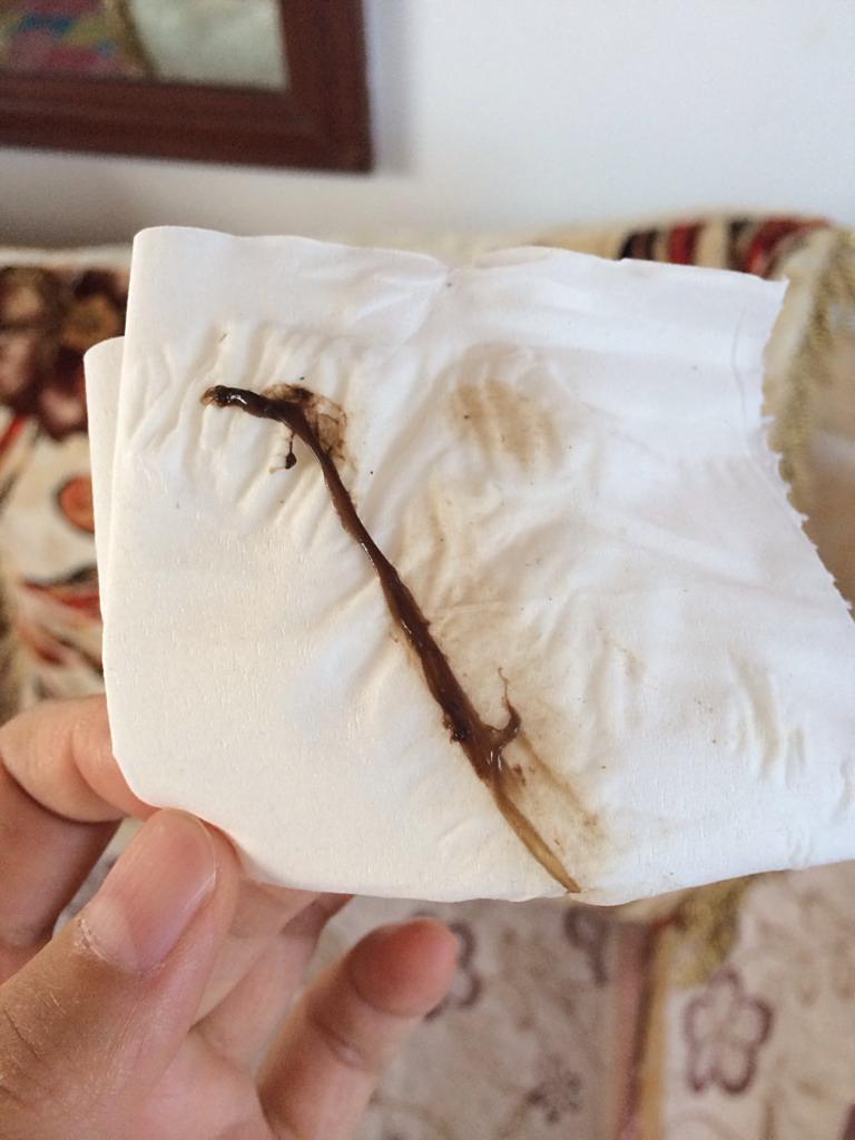 怀孕23周多了,今早发现小便后有褐色黏稠物,怎么回事,有点害怕