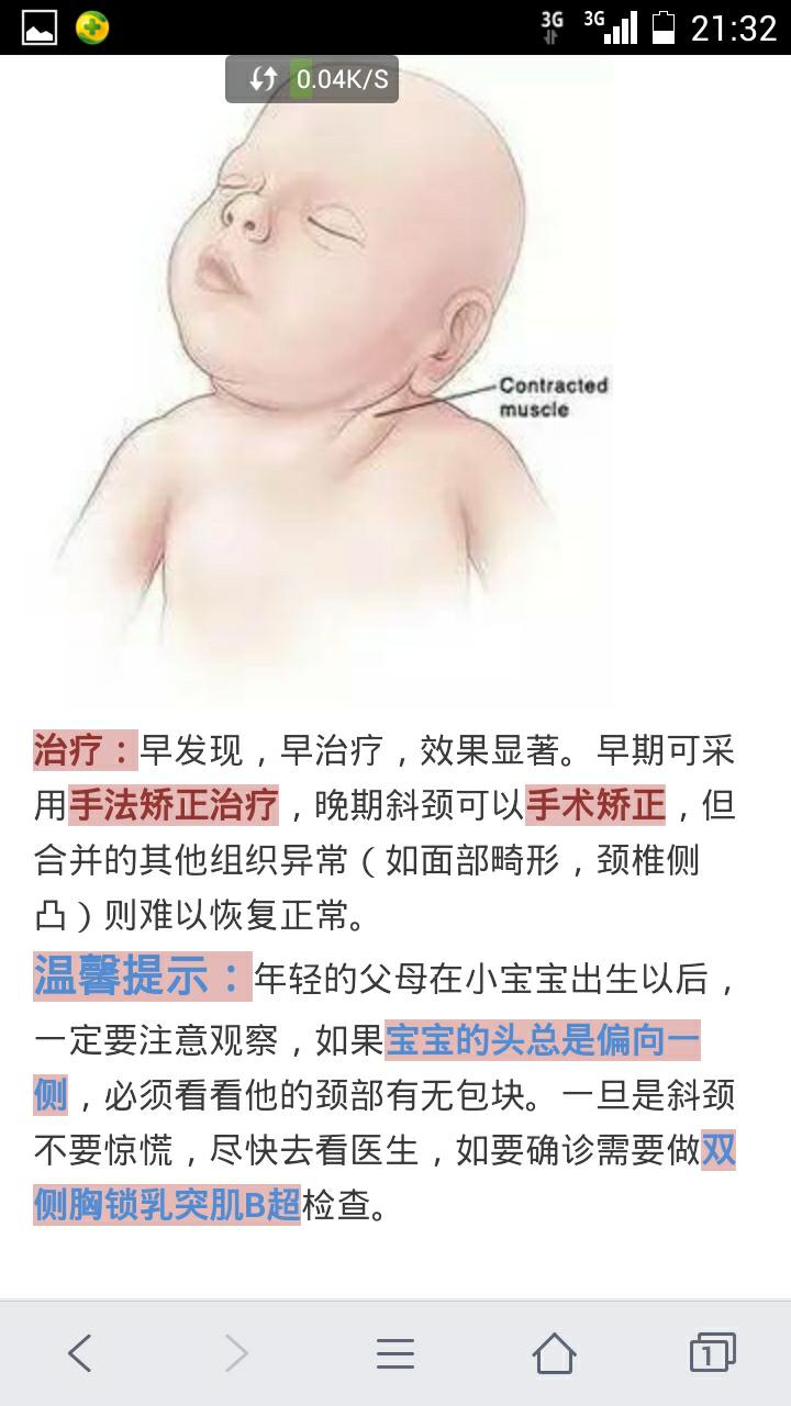 六个月宝宝斜颈图片图片
