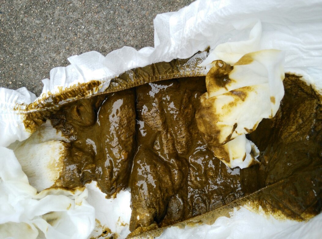 8个半月的宝宝,拉的大便,黑绿黑绿的,附图一张