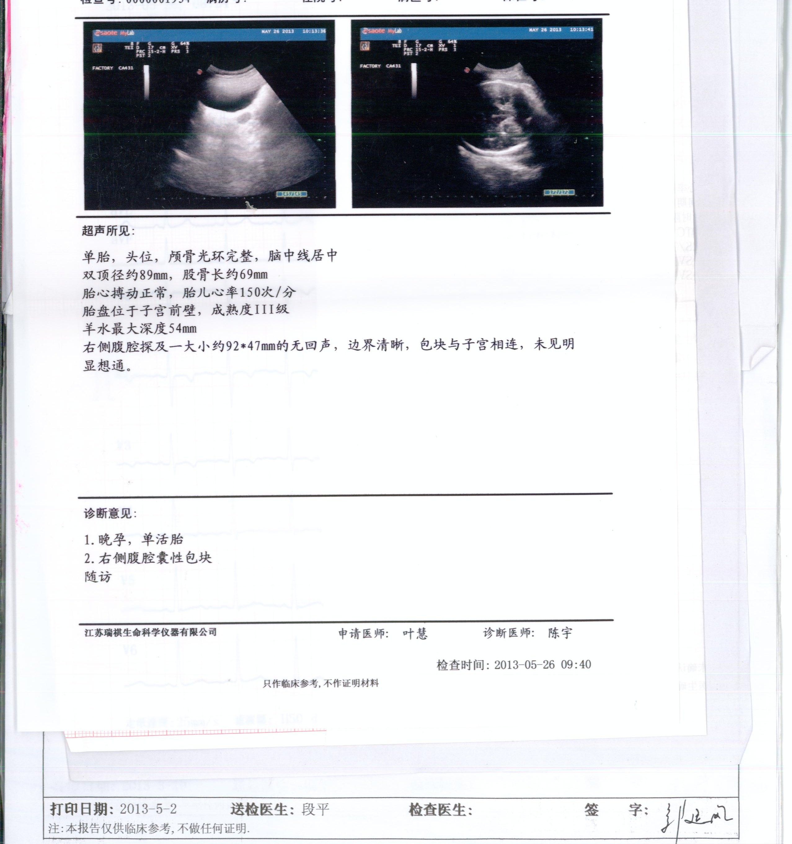 请医生帮我看看B超单子，怀孕46天，HCG：15480，孕酮10.8 能排除宫外孕吗，胚胎发育正常吗？ - 百度宝宝知道
