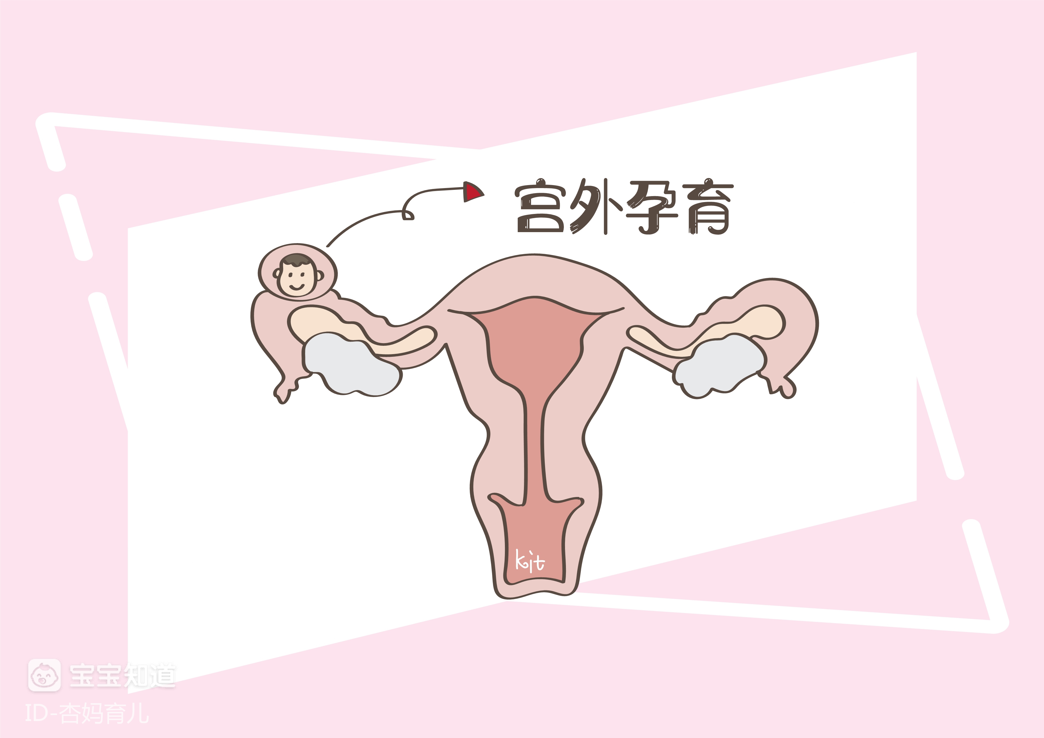 怀孕初期不能过于粗心,只有b超这三项稳定,才算瓜熟落地