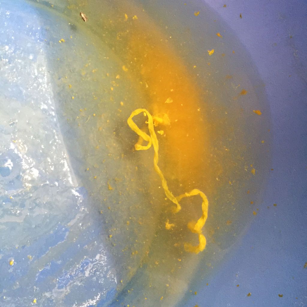 虫,建议看医生 匿名用户    2016-04-22 14:18 长虫子了,这是猪绦虫