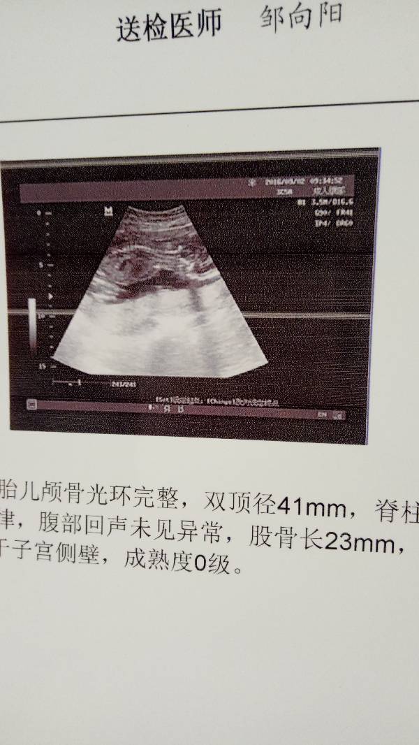 怀孕四个月bc单子帮看下是男是女