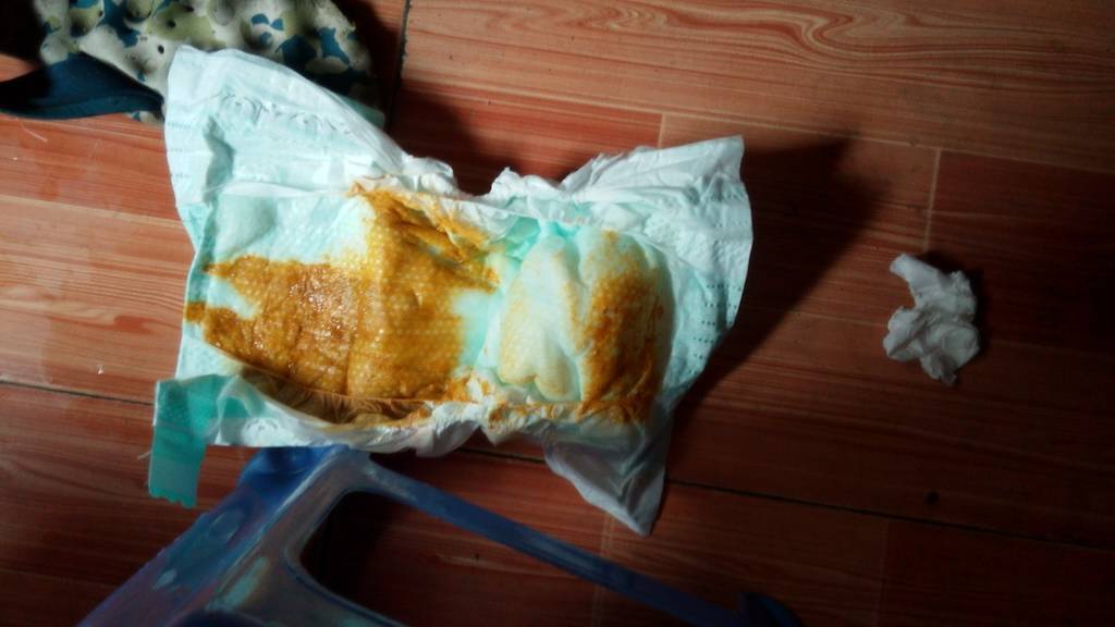 这臭臭会不会太稀,正常吗?