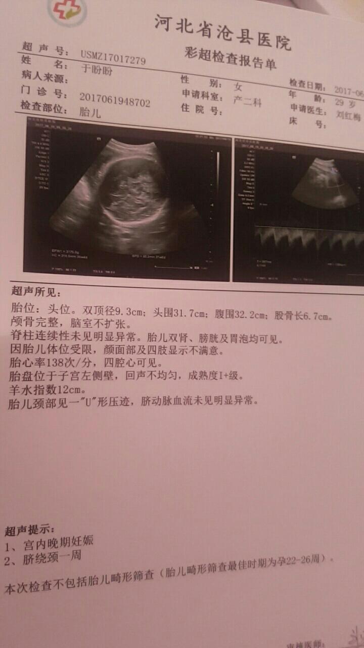 胎儿37周发育标准数值图片