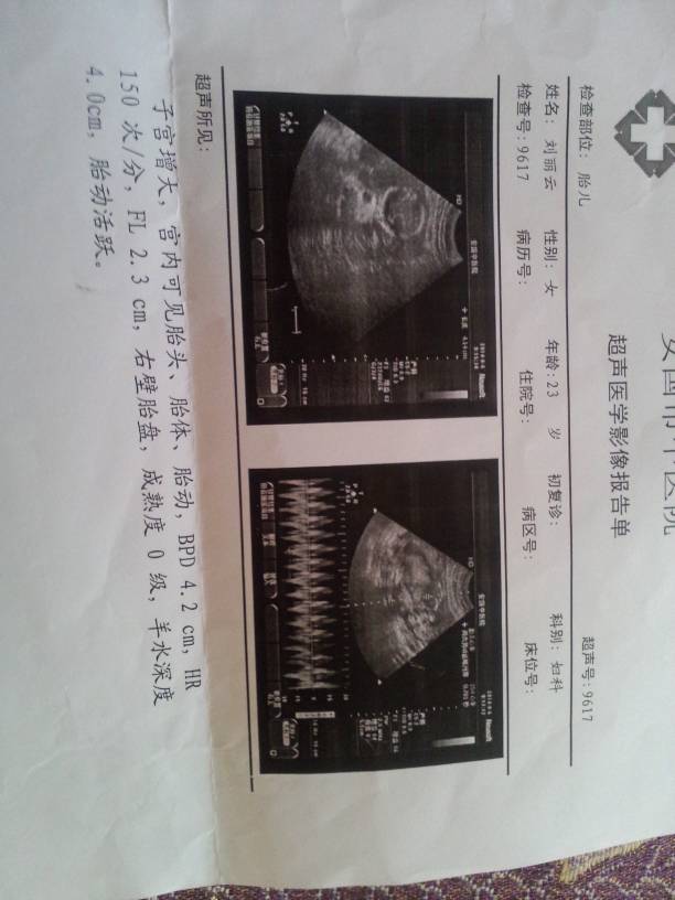 怀孕18周做的彩超小宝宝的图不清楚请问医生下面的结果是否正常?