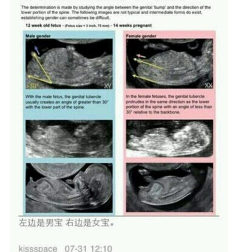 都说nt图可以看男女,可是这个姿势怎么看