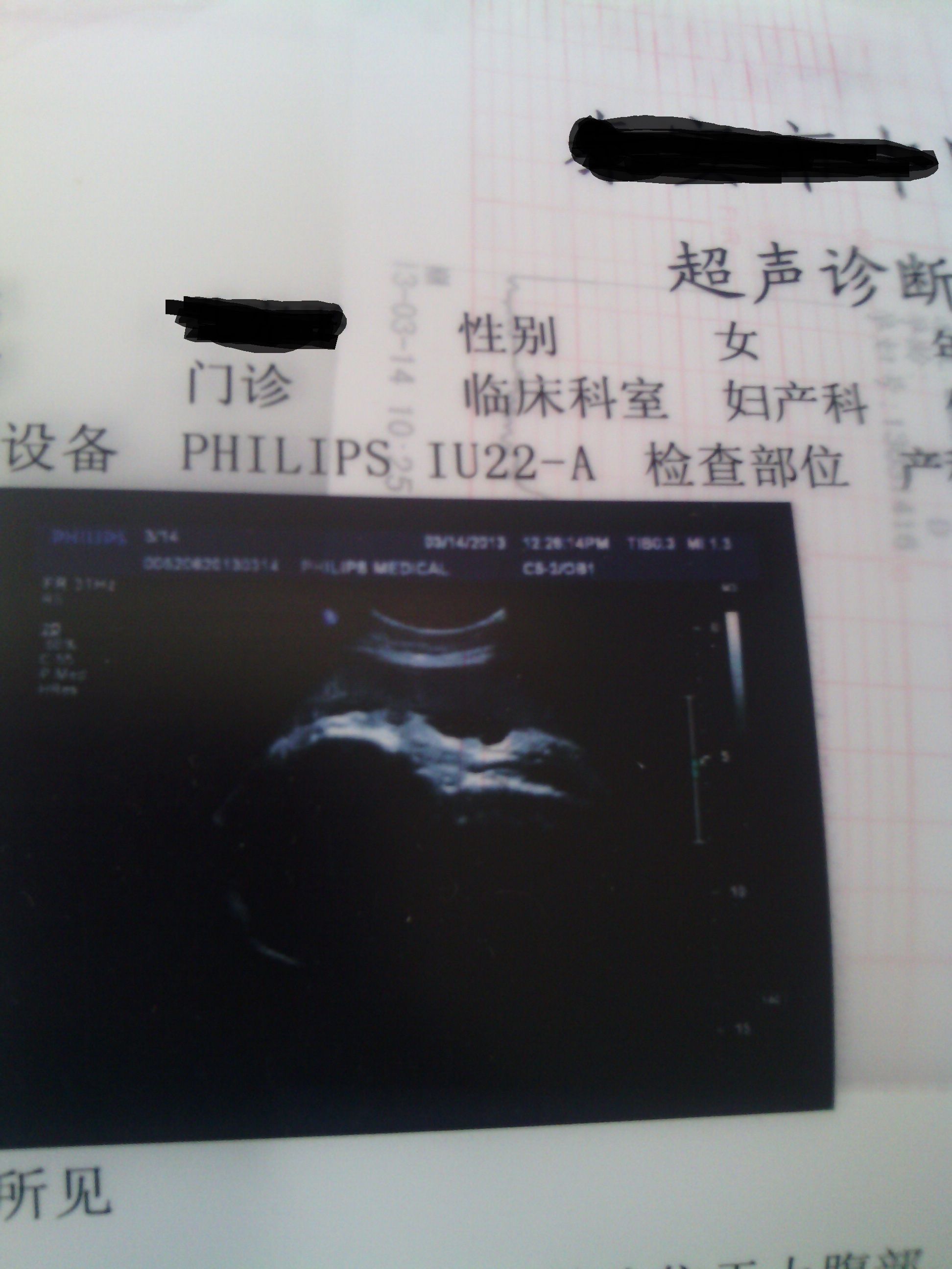胎儿1-40周发育过程高清图，瞧瞧怀孕每周宝宝长啥样？ - 柚喜问答