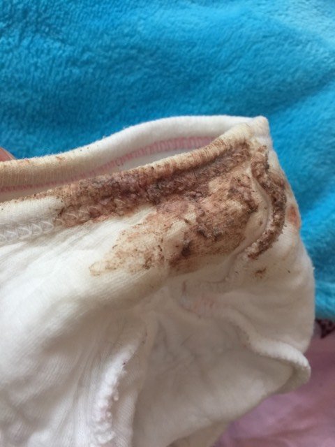 请问医生,今天抱宝宝的时候他往外喷奶,喷的满脸都