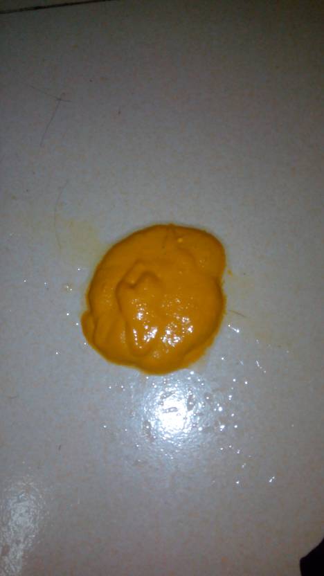 我儿子8 天没拉屎 母乳喂养 今天拉屎这样的正常吗?