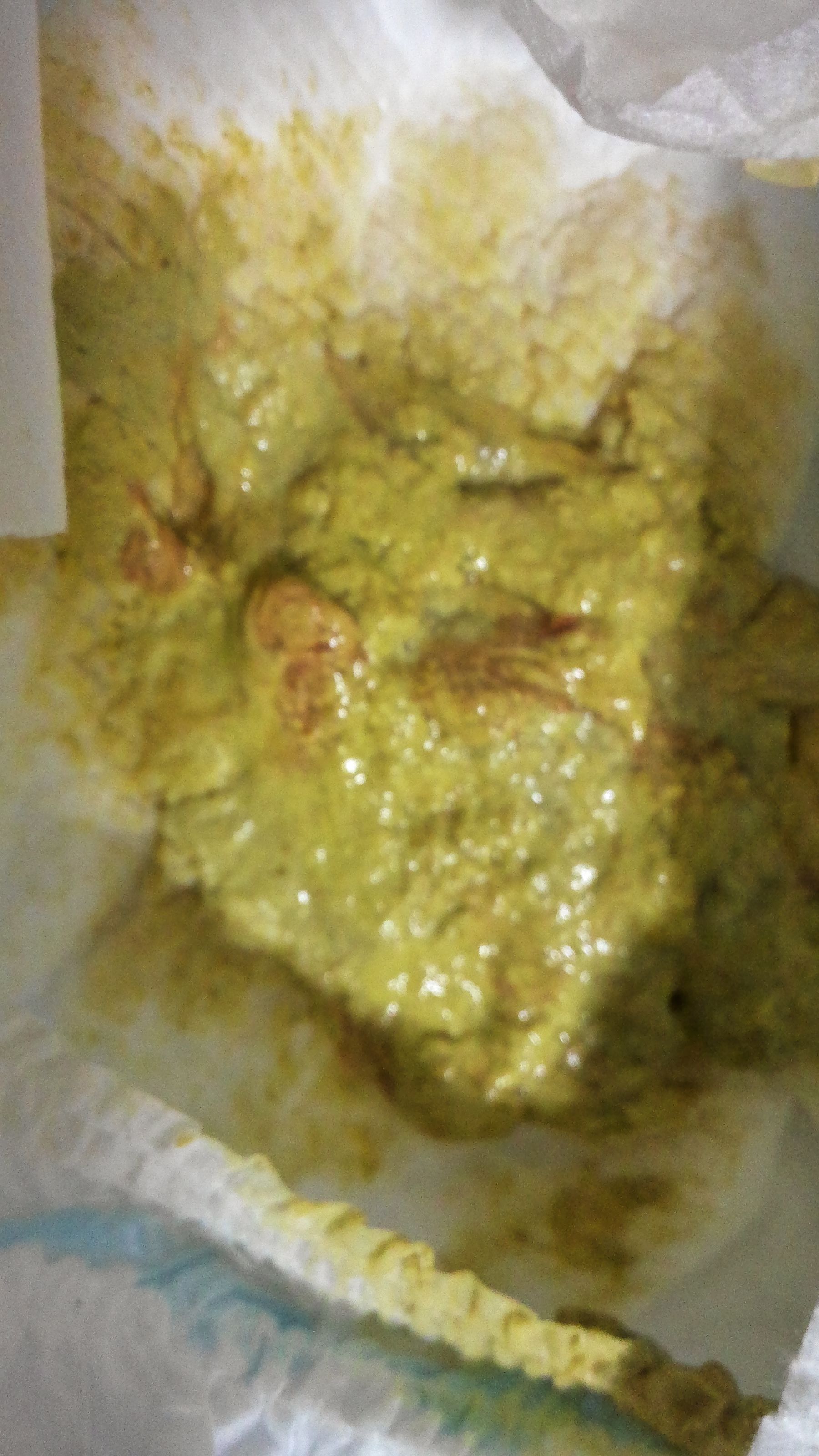 小孩大便有血,拉肚子(喝腹泻奶粉也拉),肚子不响,这是怎么回事呢?