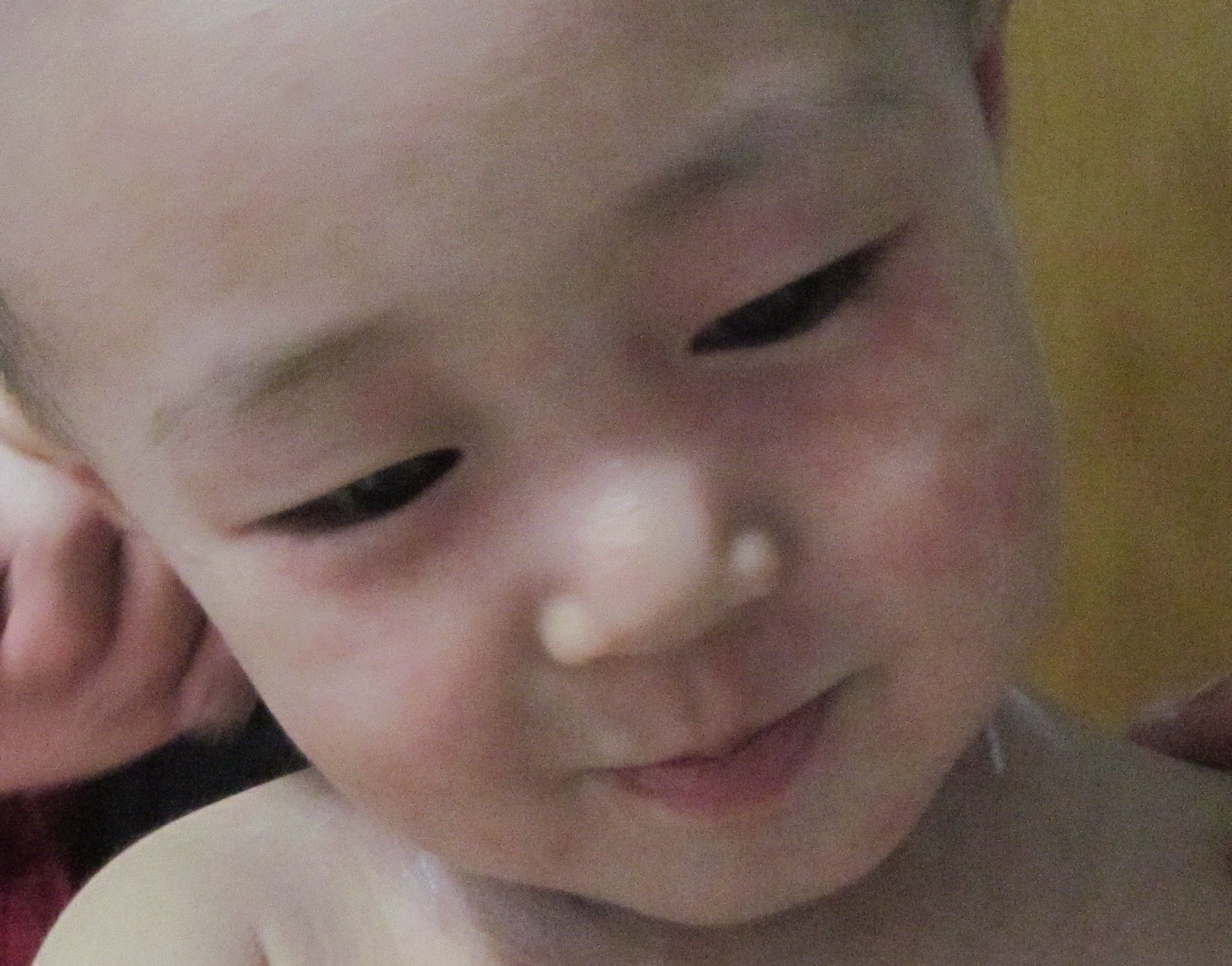 宝宝脸上有很多小红点，并且很痒，(有图）用湿疹膏等等药涂了没用 - 百度宝宝知道