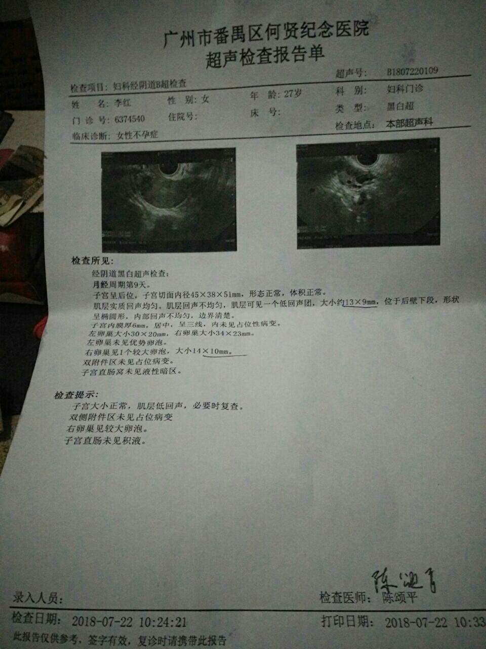 卵巢囊肿ca125图片
