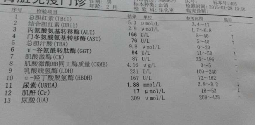 三個月大嬰兒丙氨酸氨基轉移酶門冬氨酸基轉移酶y谷氨酰轉肽酶高