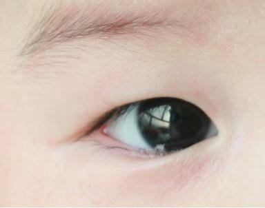 宝宝左眼总是泪汪汪的,时不时流眼泪,这是怎么了