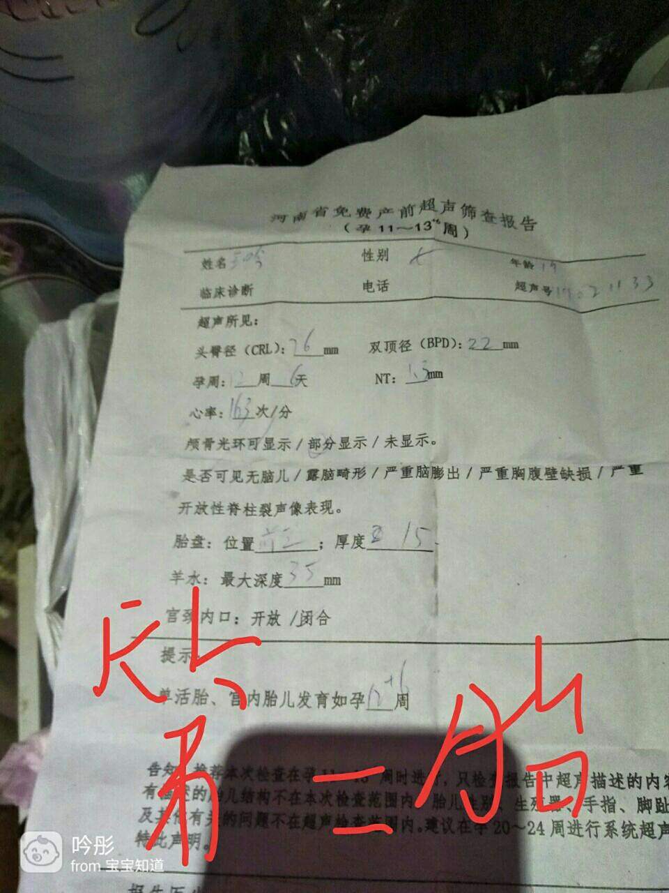 第一胎和第二胎差别好大