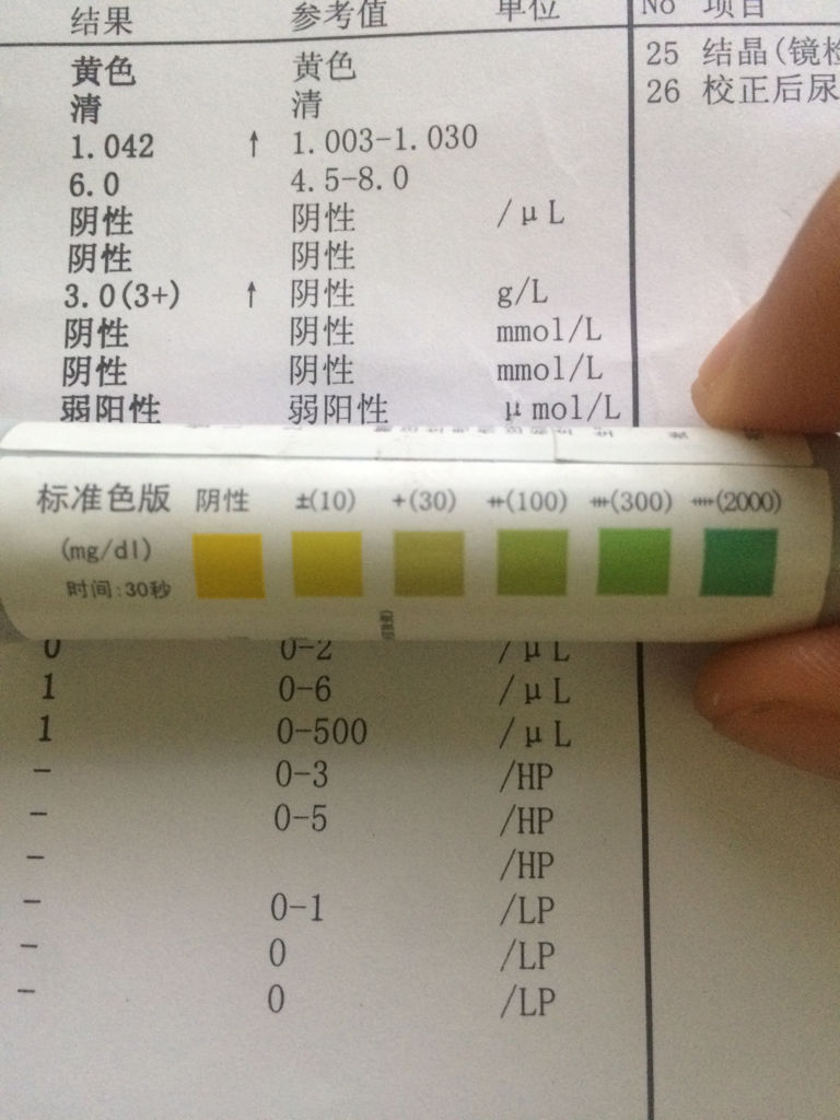 0(3 ),之后我自己去买了尿蛋白试纸检测,每次检测都在 (30)