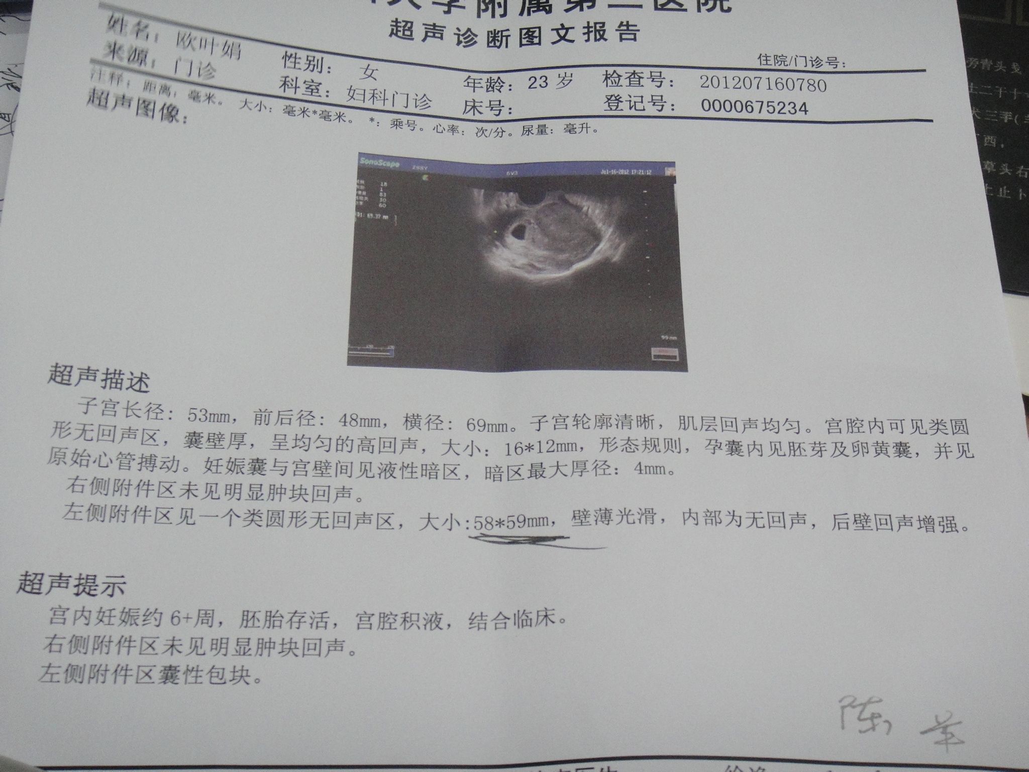 帮忙看下孕16周彩色B超图 今天带老婆去医院检查，主要是想看看胎儿的发育情况（排畸、唐筛） - 百度宝宝知道