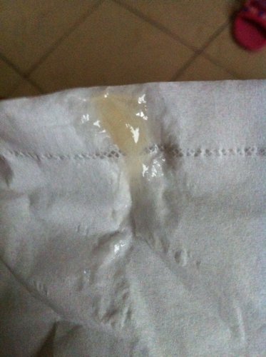 白带这个样子正常吗?没有味道