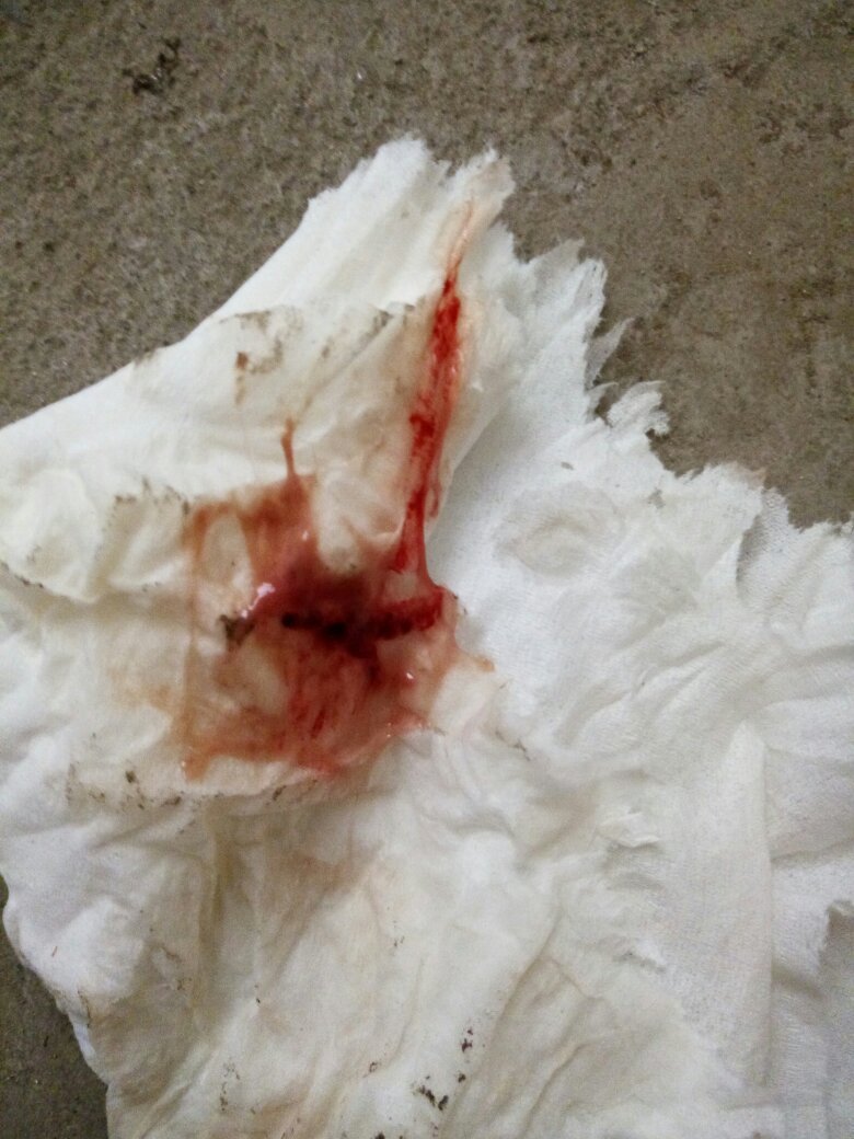 白带里面有血丝,昨天还少一点,今天就多了,请问这是月经吗,以前月经来