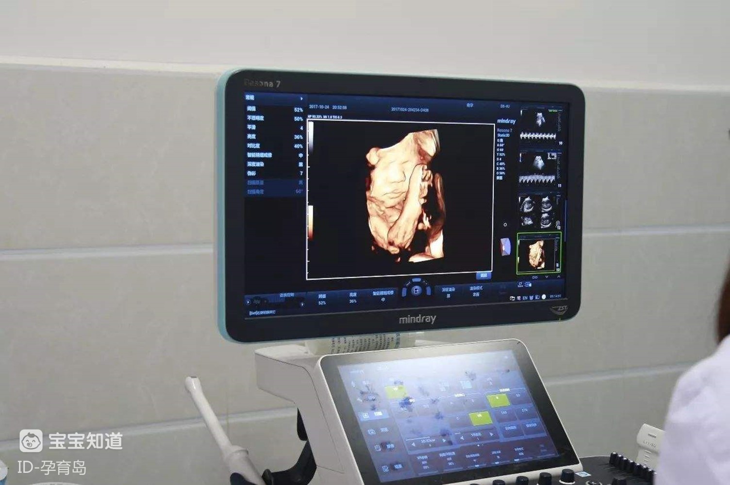 孕期给胎儿照"四维"时,可以看出这几点小秘密,你看出来了吗?